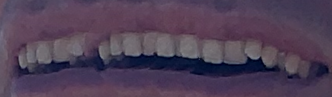 banner of teeth